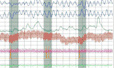 심리생리검사 관련 사진